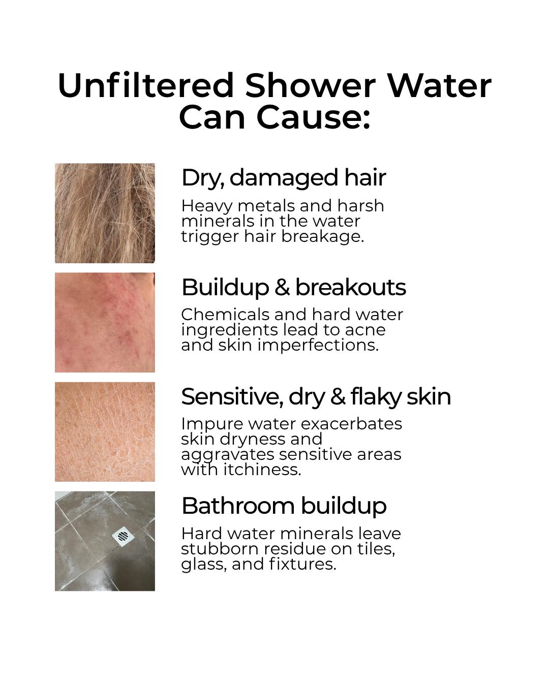 Ngilla Flow Shower Filter