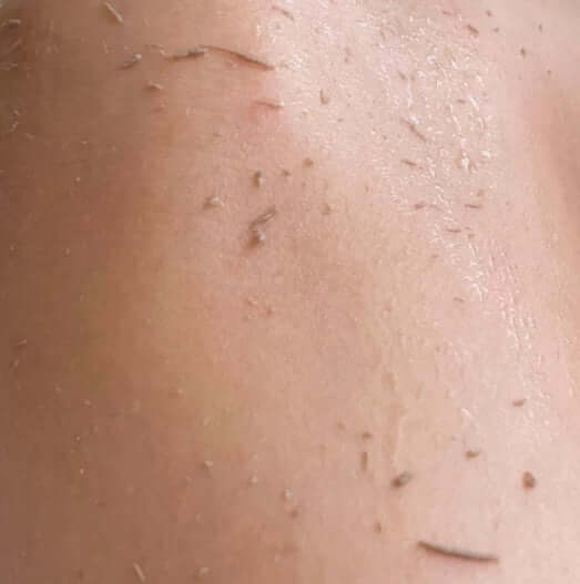 close-up of exfoliated skin after using Ngilla Flow mitt