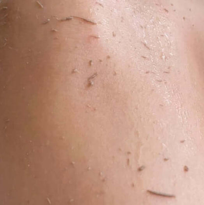 close-up of exfoliated skin after using Ngilla Flow mitt